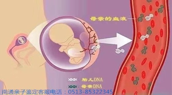 南通崇川区无创产前亲子鉴定哪里做/南通专业亲子鉴定机构